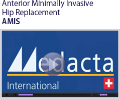 Anterior Minimally Invasive Hip Replacement - Rose Associates, Inc - A Surgical Implant Distributor