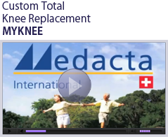 Custom Total Knee Replacement - Rose Associates, Inc - A Surgical Implant Distributor