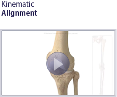 Kinematic Alignment